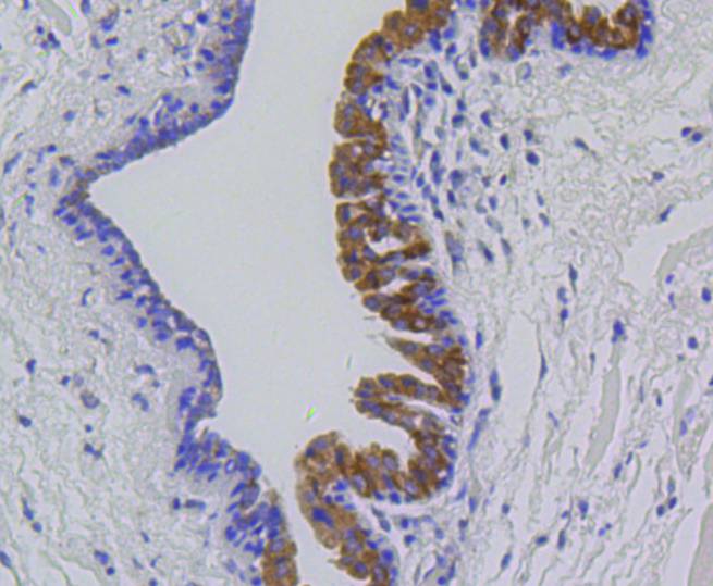 MMP12 Rabbit mAb