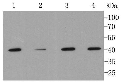 MMP12 Rabbit mAb