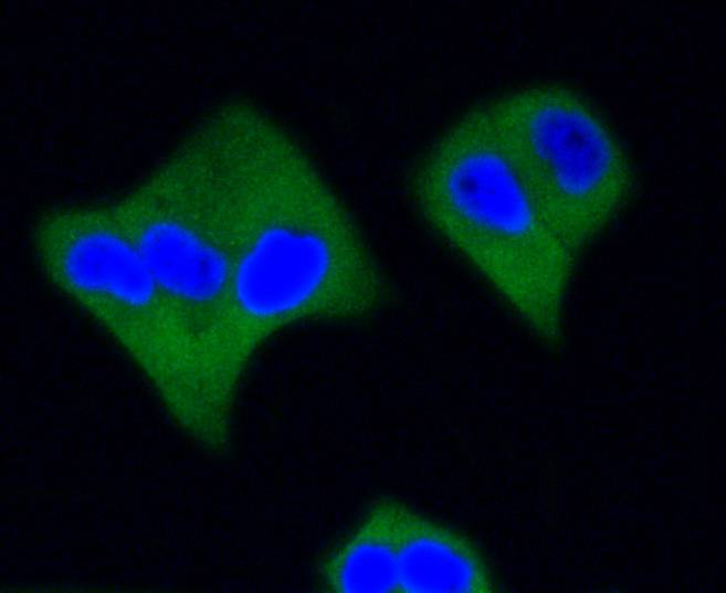 Active Caspase-3 Rabbit mAb