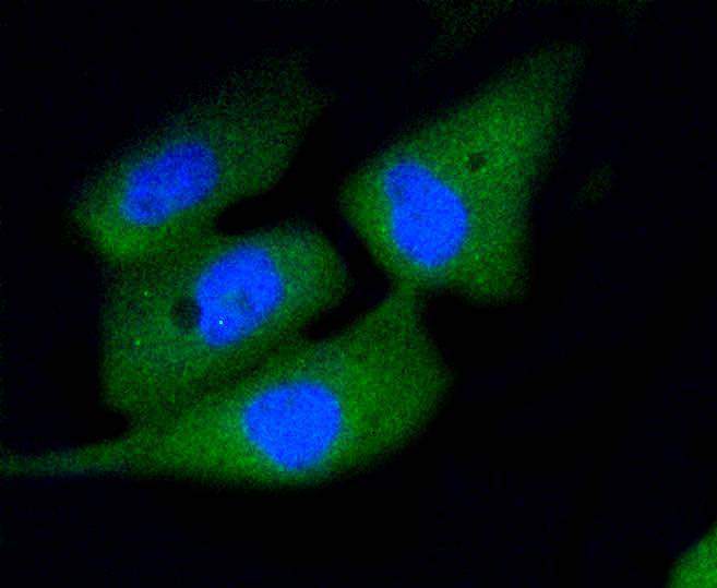 Active Caspase-3 Rabbit mAb