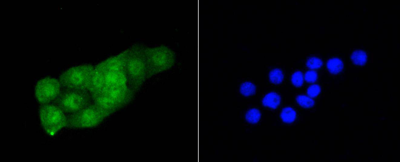 Cdk2 Rabbit mAb