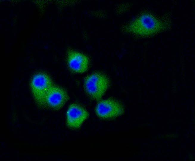 Cdk2 Rabbit mAb