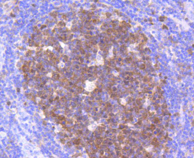 Cdk2 Rabbit mAb