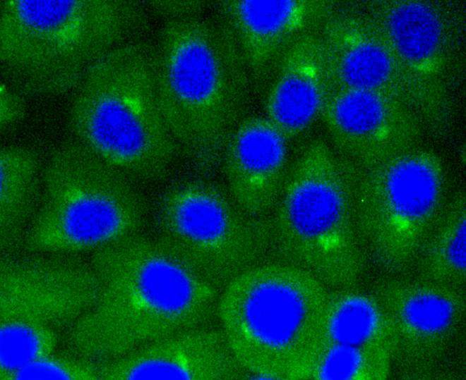 Caveolin-1 Rabbit mAb