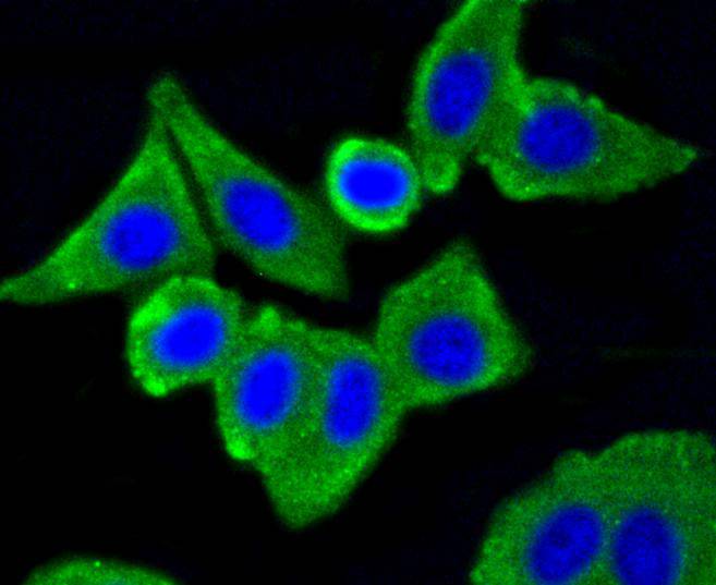 Caveolin-1 Rabbit mAb