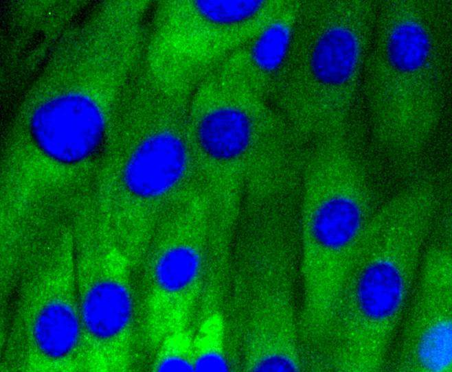 Caveolin-1 Rabbit mAb