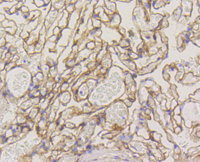 Caveolin-1 Rabbit mAb