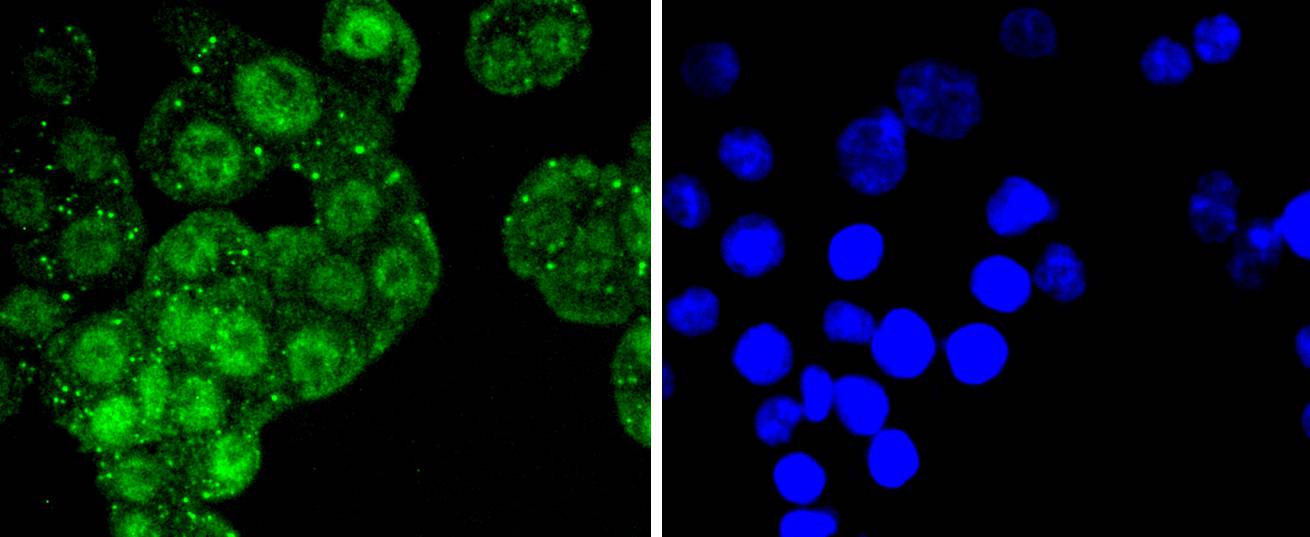 ATF2 Rabbit mAb