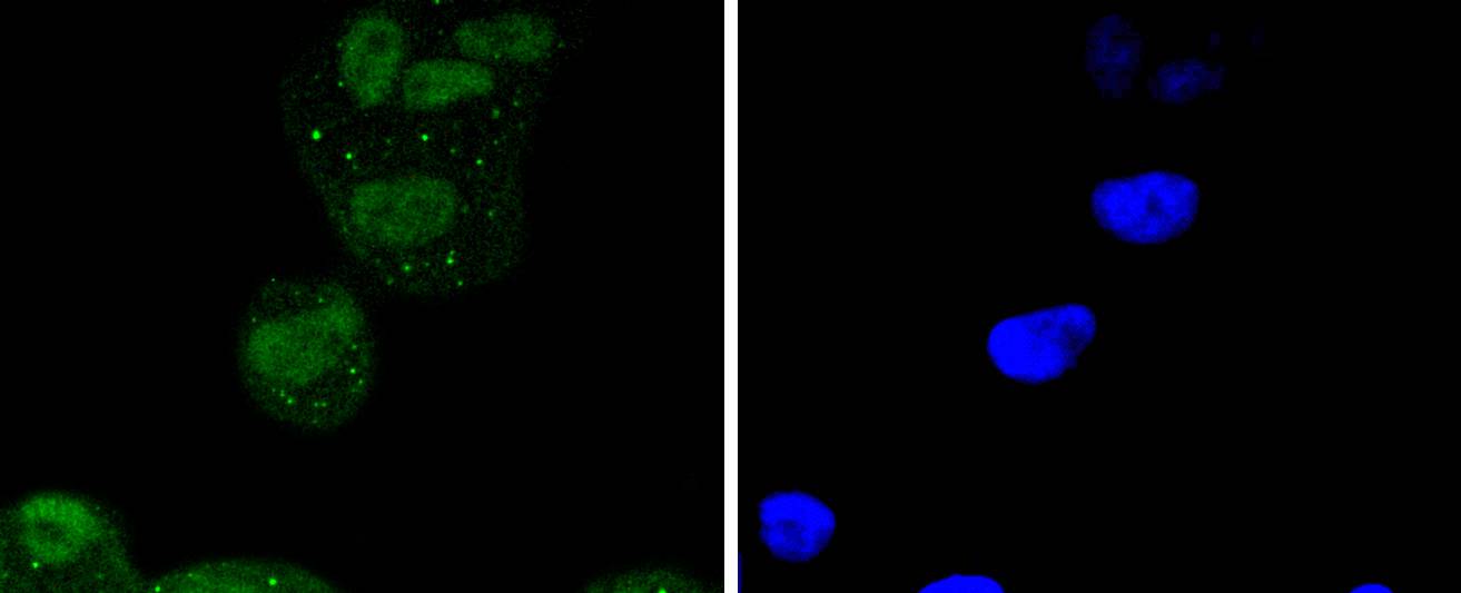 ATF2 Rabbit mAb