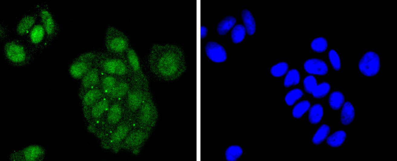 ATF2 Rabbit mAb