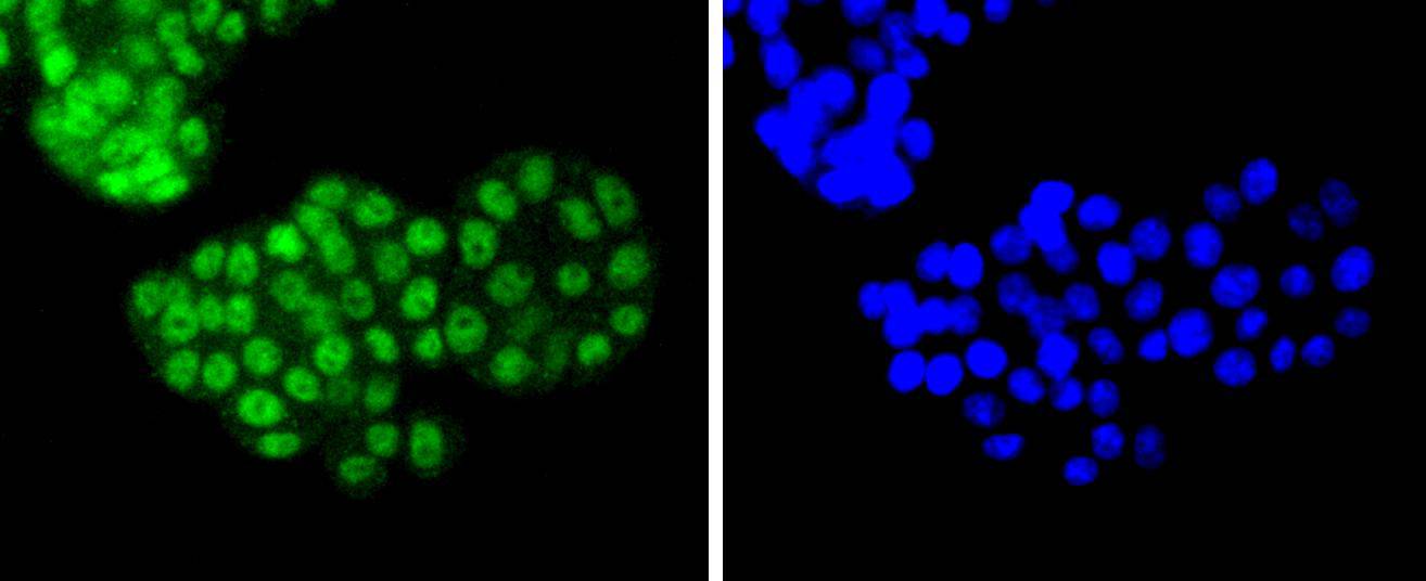 ATF2 Rabbit mAb