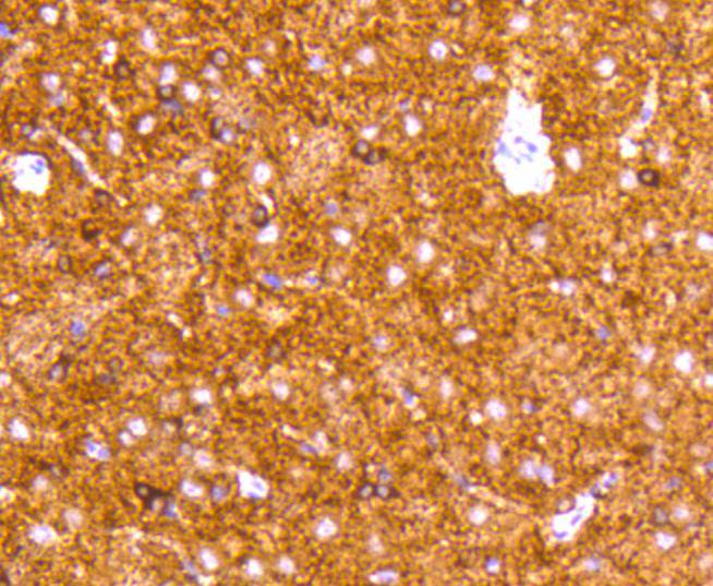 Tau Rabbit mAb