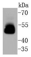 Tau Rabbit mAb