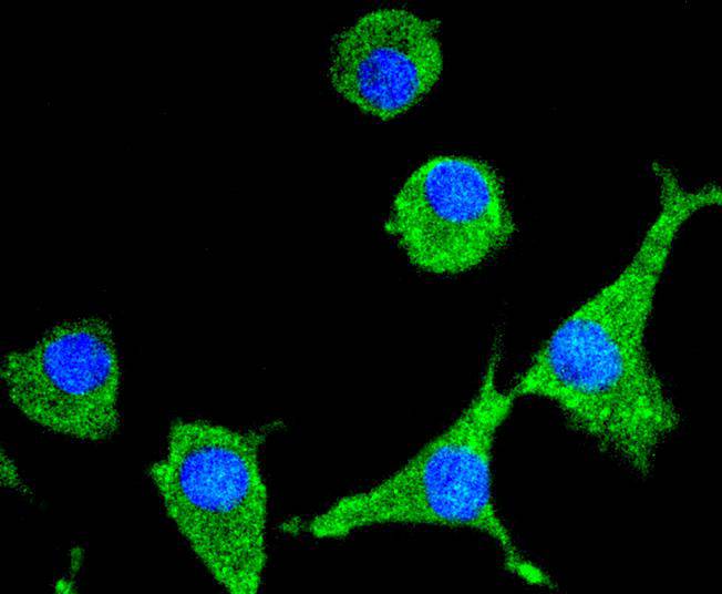 SIRT1 Rabbit mAb