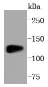 SIRT1 Rabbit mAb