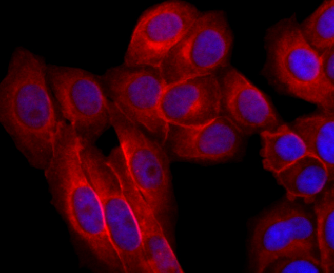 EGFR Rabbit mAb