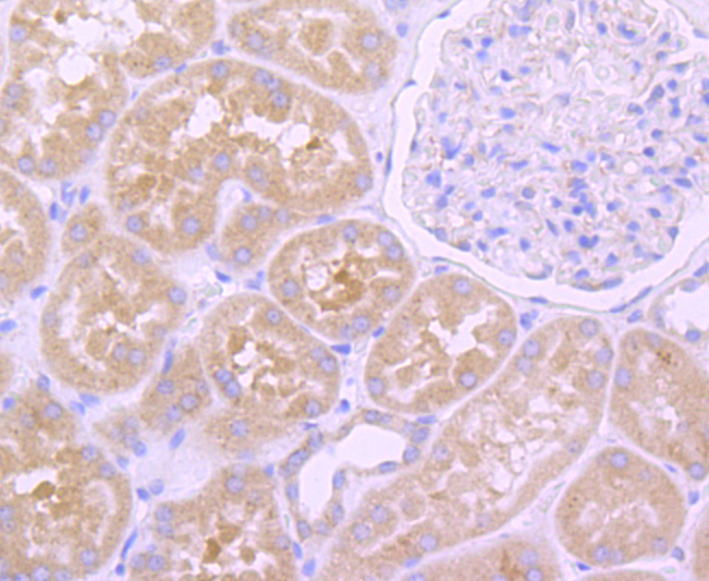 EGFR Rabbit mAb