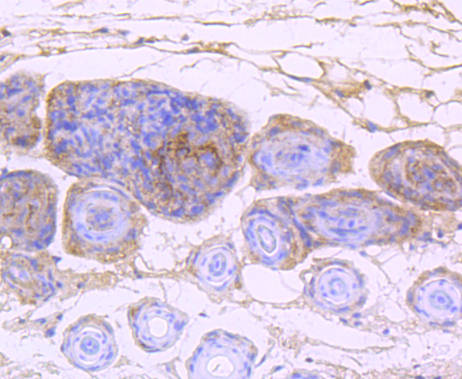 EGFR Rabbit mAb