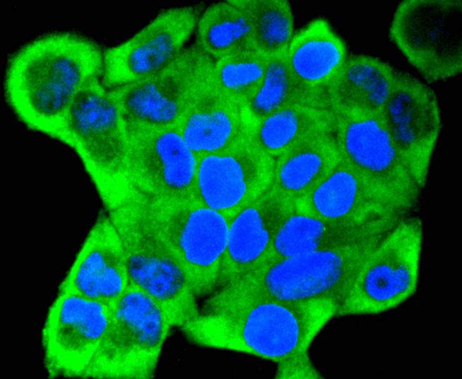 Cytokeratin 18 Rabbit mAb