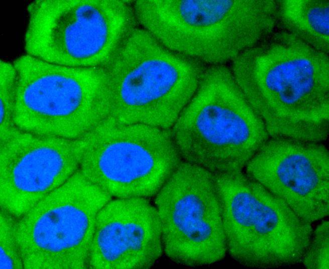 Cytokeratin 18 Rabbit mAb