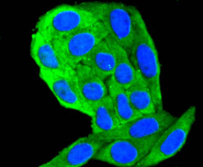 Cytokeratin 18 Rabbit mAb