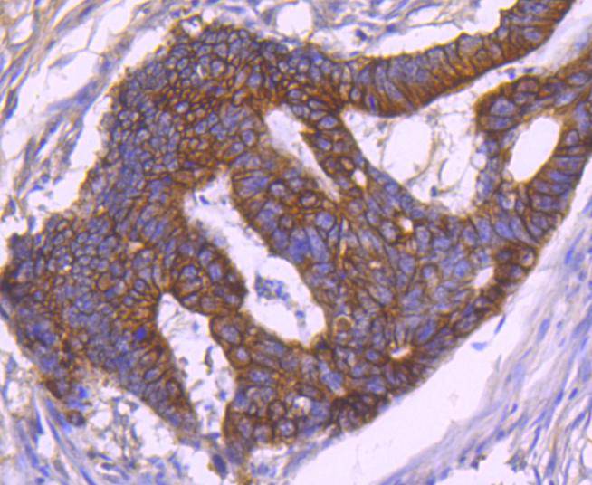 Cytokeratin 18 Rabbit mAb