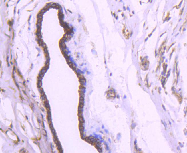 Cytokeratin 18 Rabbit mAb