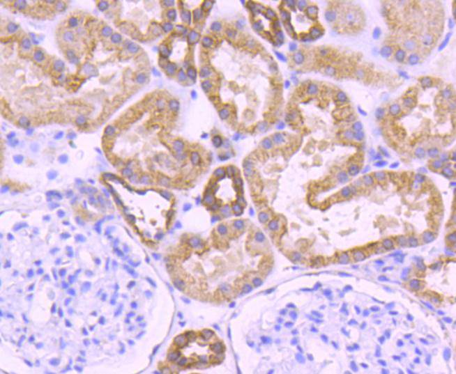 Cytokeratin 18 Rabbit mAb