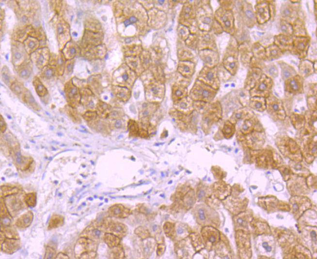 Cytokeratin 18 Rabbit mAb