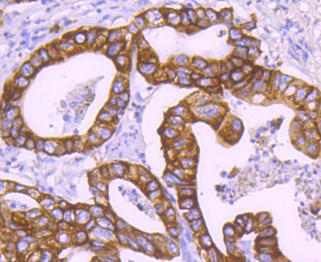 Cytokeratin 18 Rabbit mAb