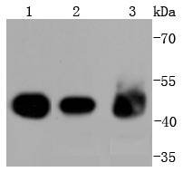 Cytokeratin 18 Rabbit mAb