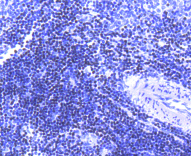 SATB1 Rabbit mAb