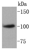 SATB1 Rabbit mAb