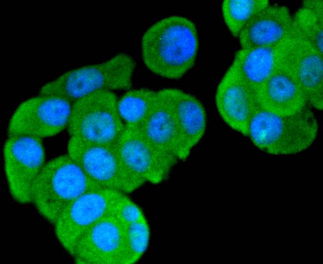 FOXO3A Rabbit mAb