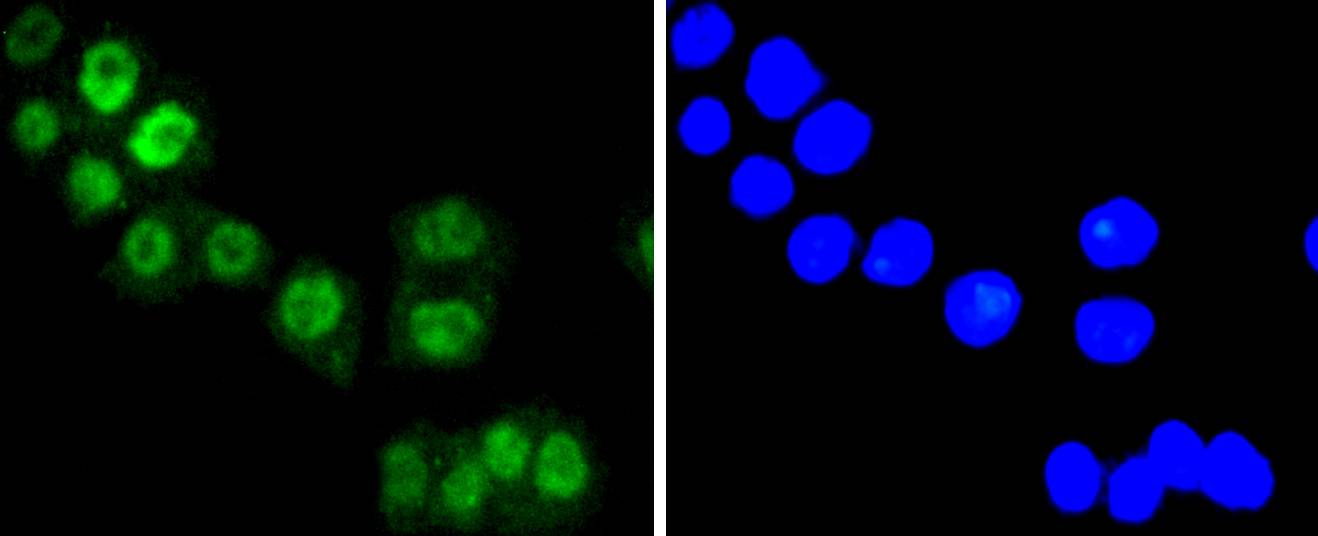 FOXO3A Rabbit mAb