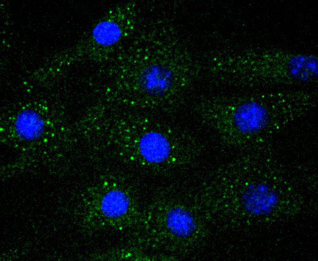 ERK1 Rabbit mAb