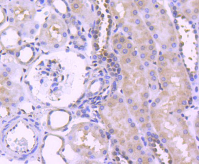 ERK1 Rabbit mAb