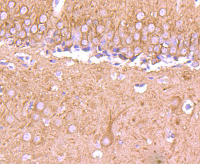 Tubulin beta-III Rabbit mAb