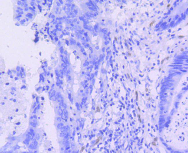 ERG Rabbit mAb