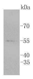 ERG Rabbit mAb