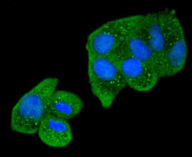 Smad2 Rabbit mAb