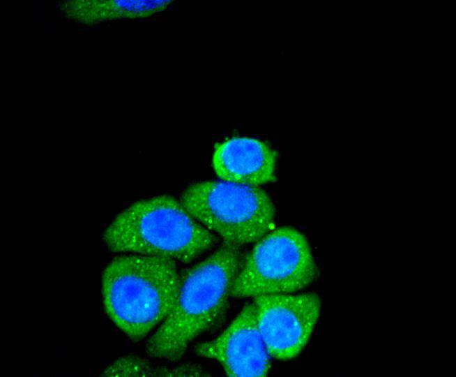 Smad2 Rabbit mAb