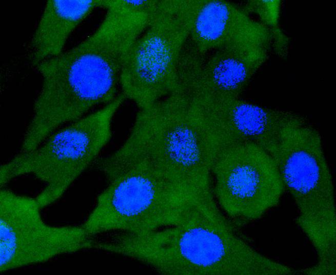 Smad2 Rabbit mAb