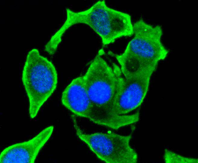 VEGF Rabbit mAb