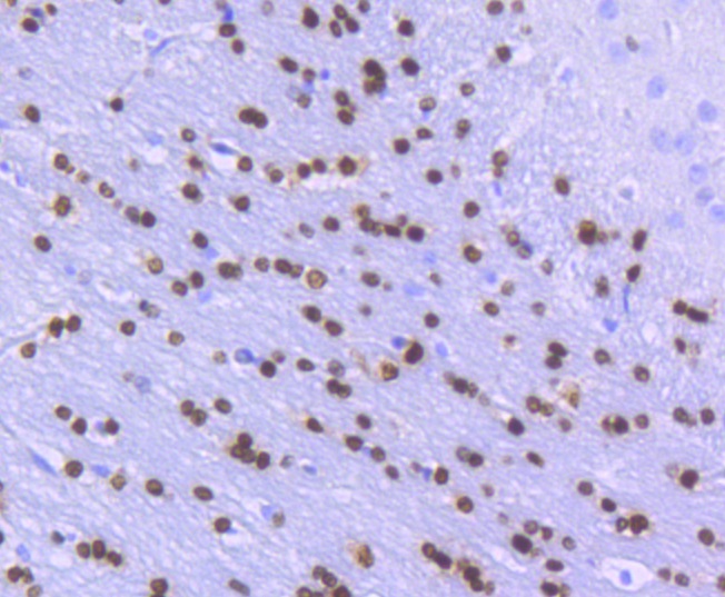 Olig2 Rabbit mAb