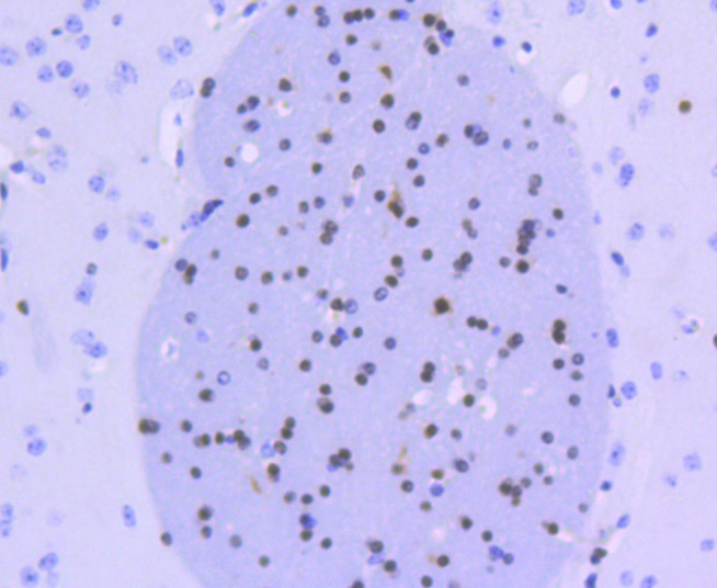 Olig2 Rabbit mAb