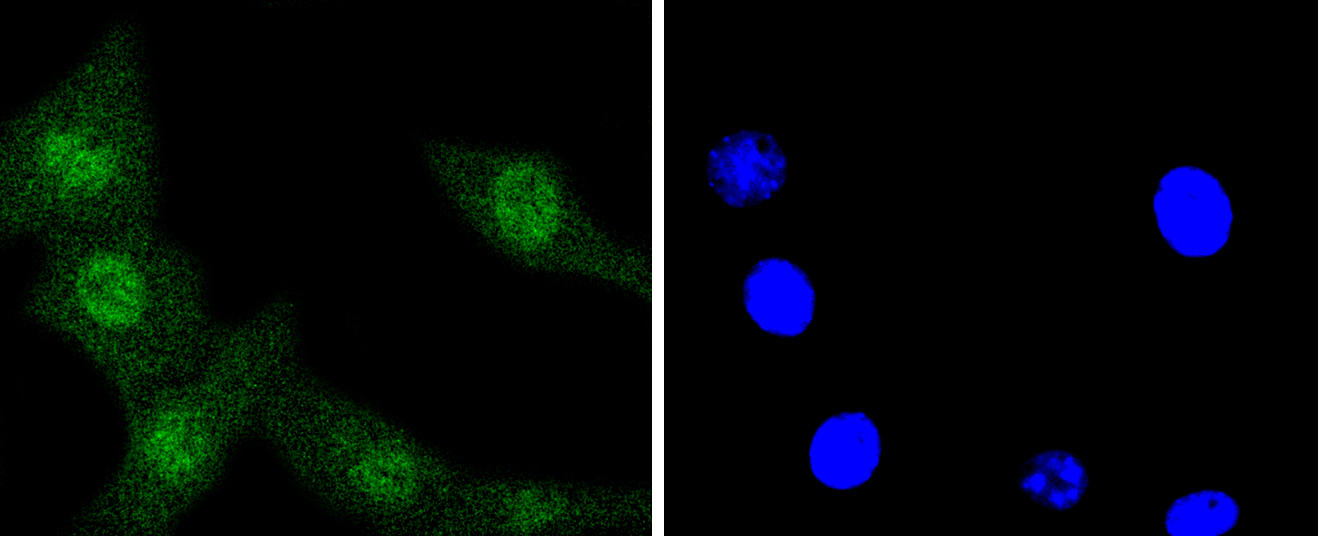 ERK1 Rabbit mAb