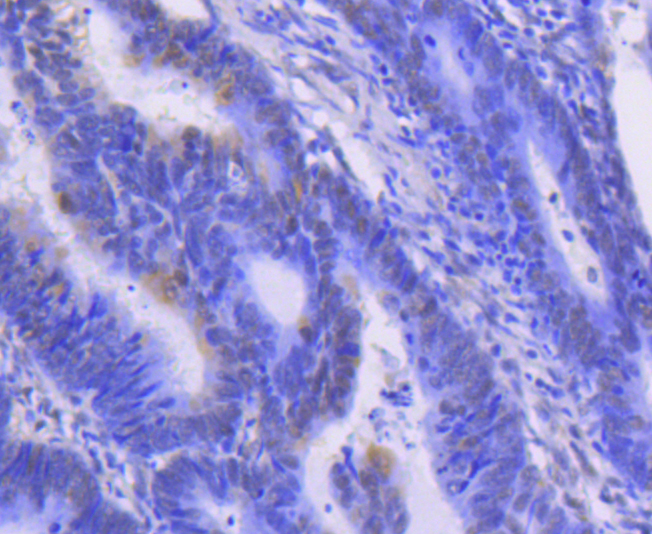 ERK1 Rabbit mAb