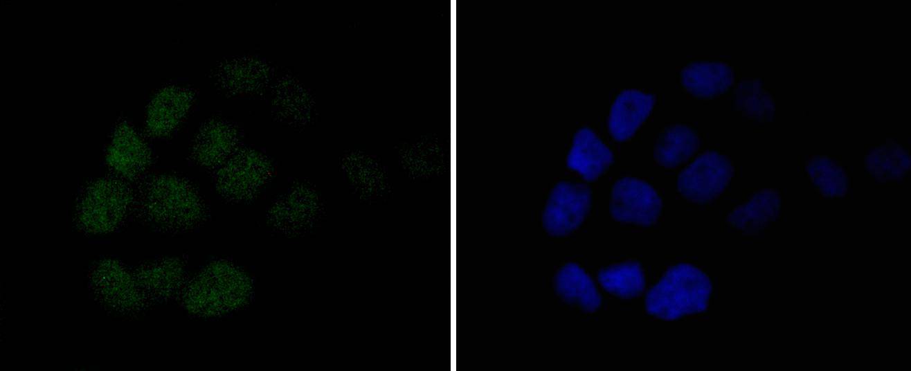 MSH6 Rabbit mAb