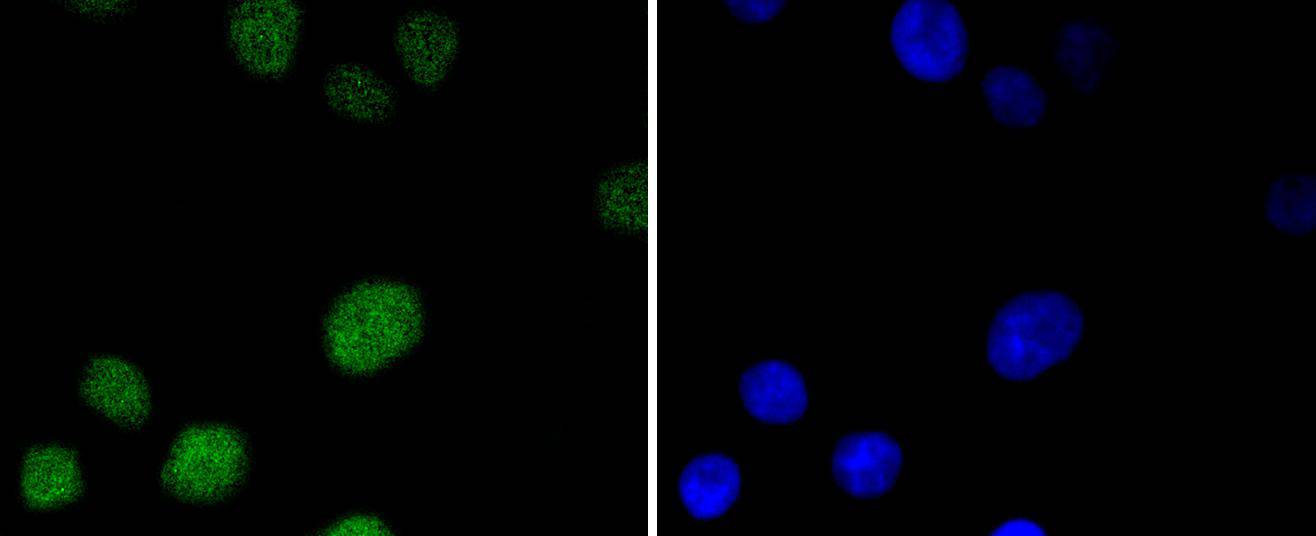 MSH6 Rabbit mAb